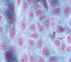 細(xì)胞侵襲、轉(zhuǎn)染